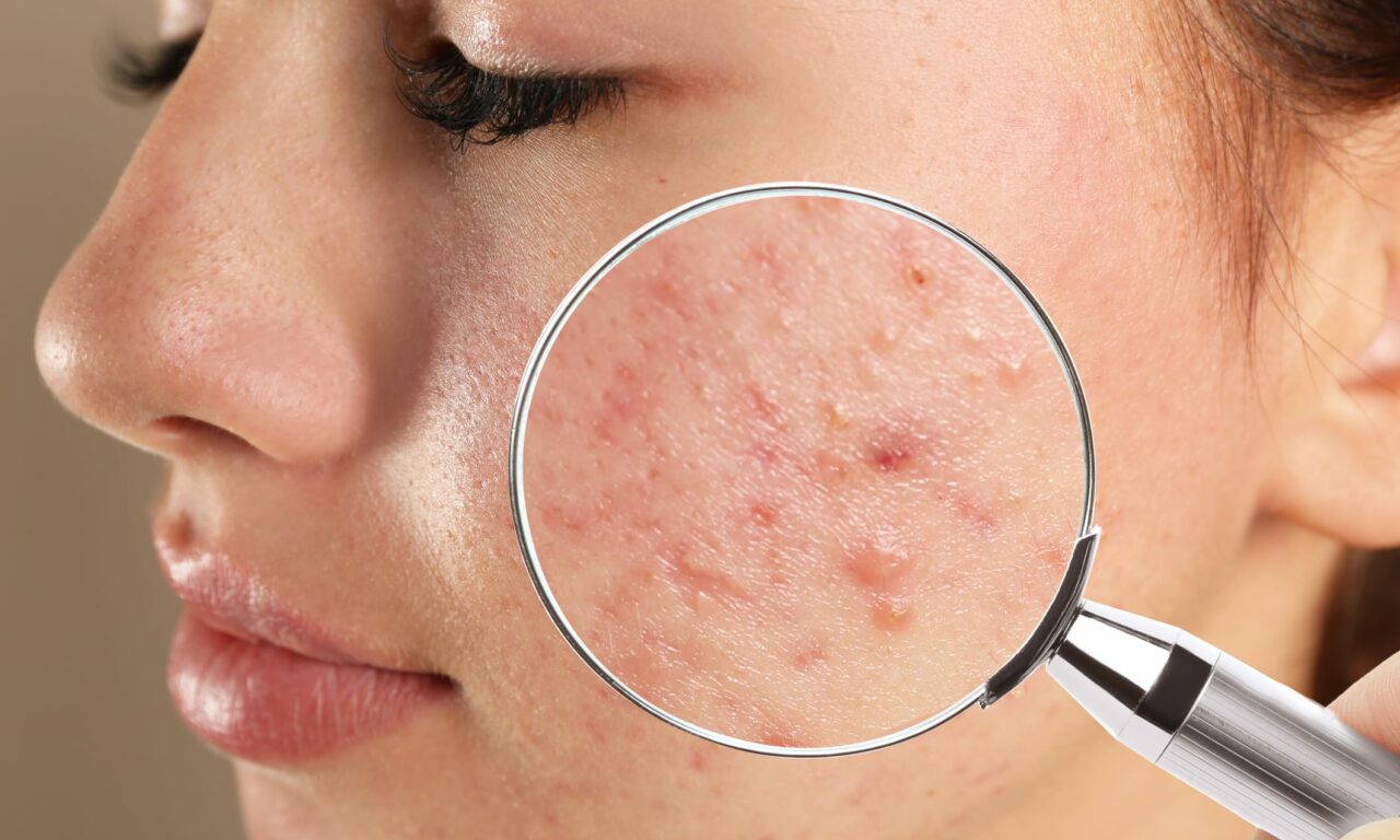 Understanding Regulatory Compliance in Dermatology Through New FDA Approvals