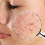 Understanding Regulatory Compliance in Dermatology Through New FDA Approvals