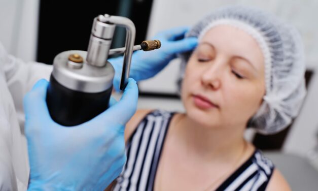 The Use of Cryotherapy in Dermatology: Applications and Techniques