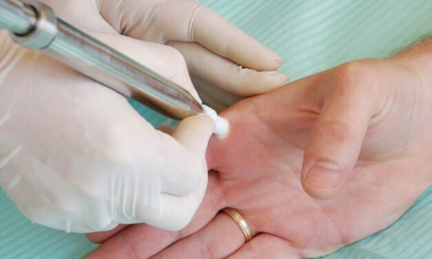 Surgical Instruments in Dermatology: Enhancing Precision and Outcomes