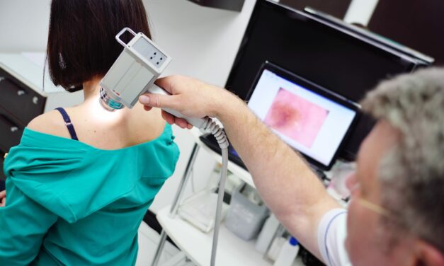 Innovations in Dermatoscopy: Improving Skin Health with Technology