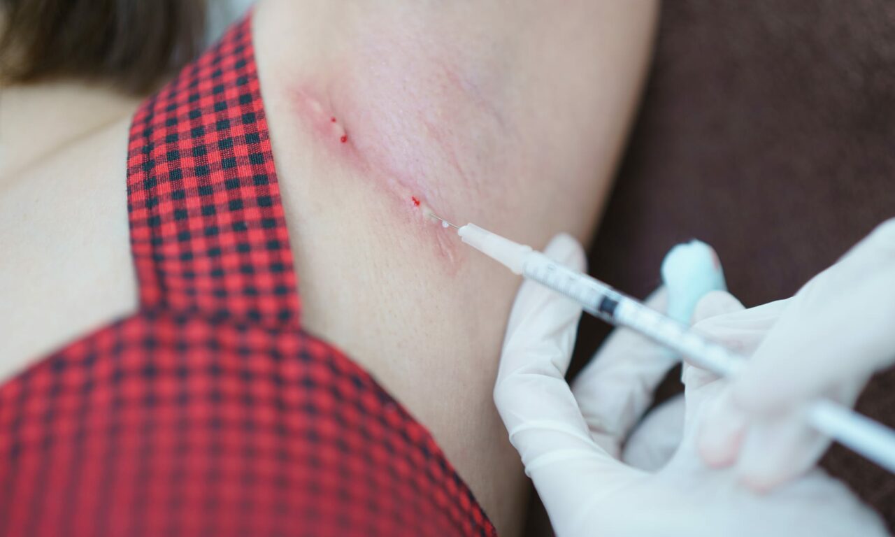 Exploring Therapeutic Injectables for Skin Conditions in Dermatology