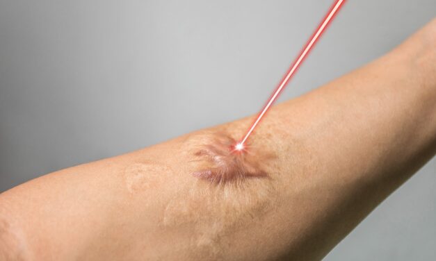 Integrating Laser Therapy in Post-Treatment Care for Dermatological Surgeries