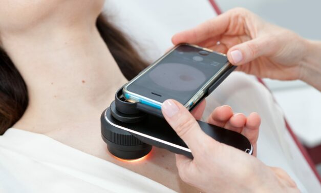 The Role of Mobile Dermatoscopes in Expanding Dermatological Care Access