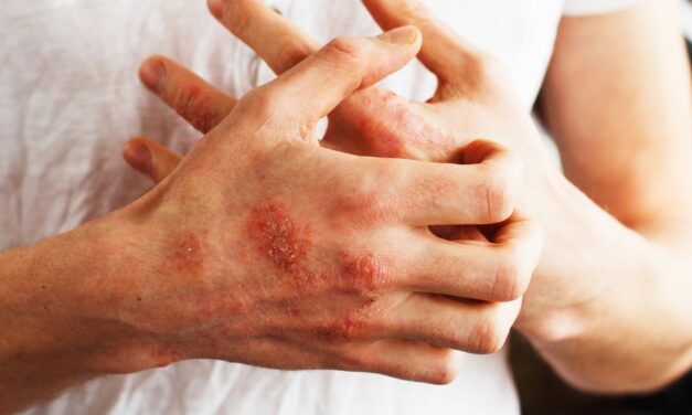 The Role of Apps in Supporting Chronic Dermatological Condition Management