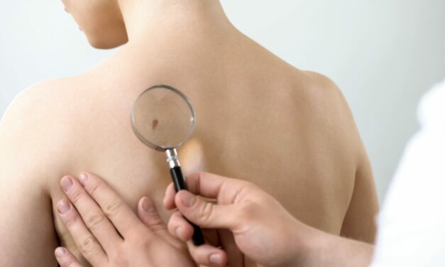 Exploring New Oral Chemotherapy in Skin Cancer Treatment
