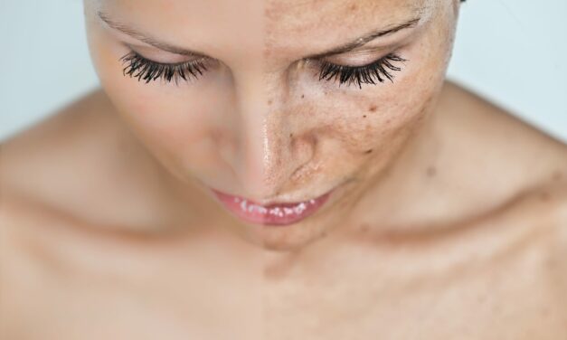 The Impact of Routine Sun Protection on Long-term Skin Health